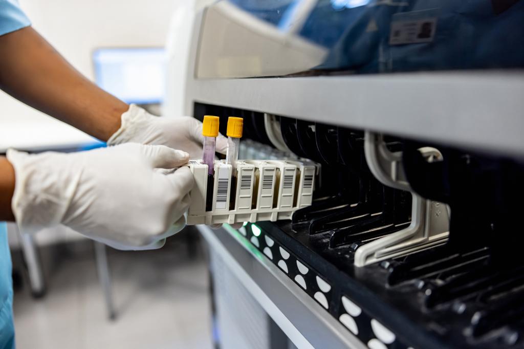 Close-up on a technician analyzing blood samples at the lab