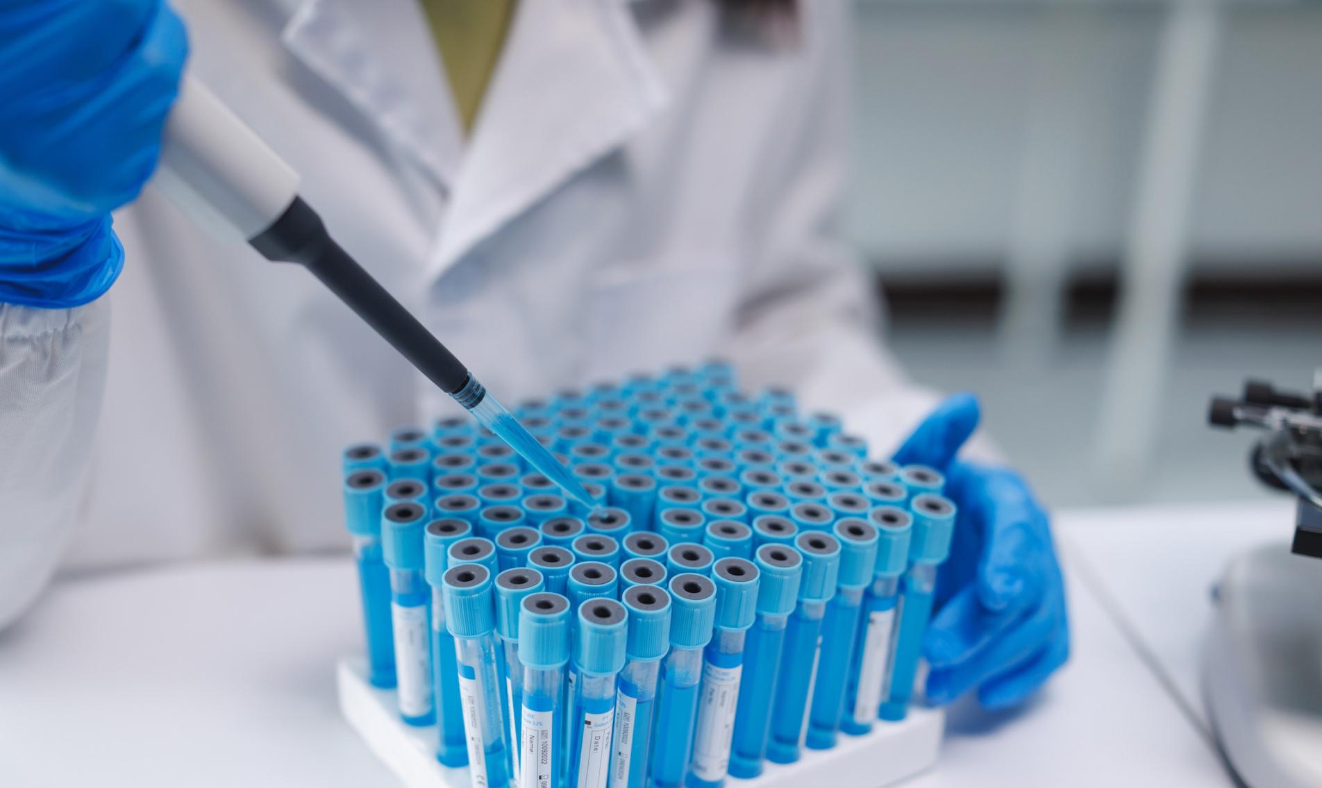 Scientist pipetting liquid samples into test tubes in laboratory